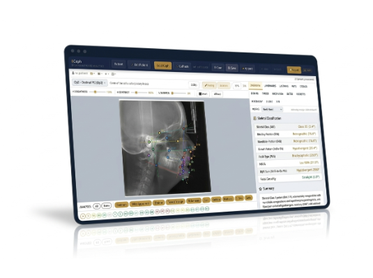 BCeph browser-based cephalometric analysis interface showing a traced lateral skull radiograph with measurements