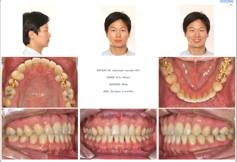 Ortho Photo Standardizer composite: standardized facial and intraoral orthodontic records for a sample patient